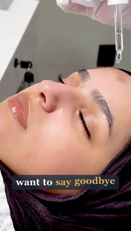 Marlow-annonse: microneedling-video